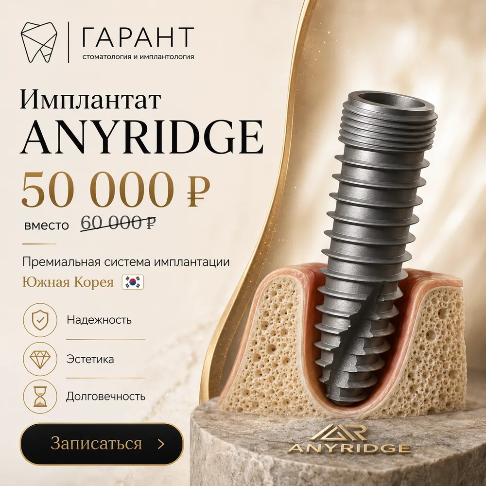 Имплант AnyRidge