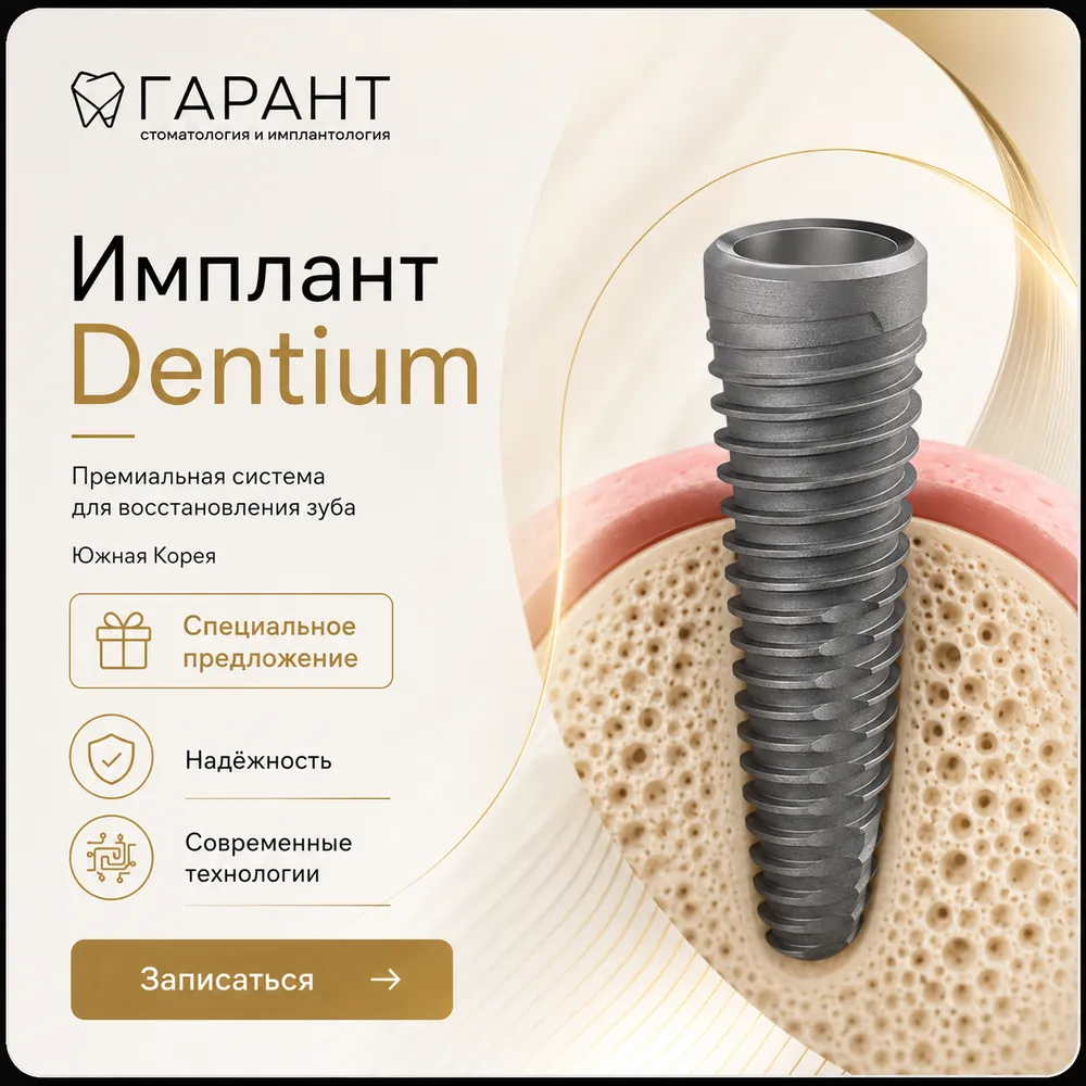 Имплант Dentium