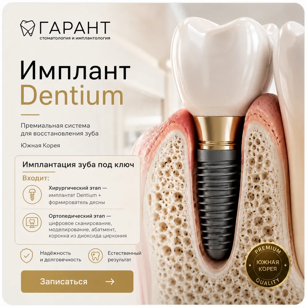 Имплантация зуба под ключ